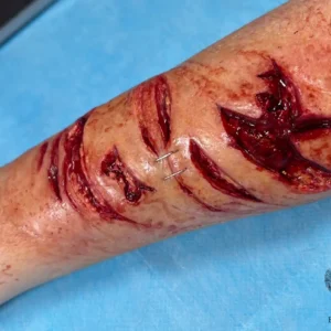 NecroSil Prosthetic